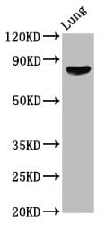 ITGB6 / Integrin Beta 6 Antibody