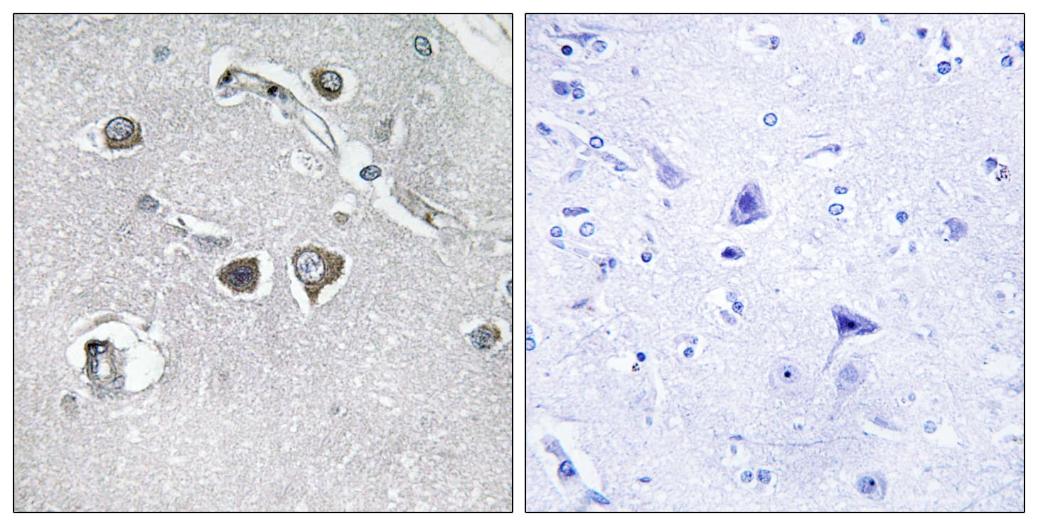 Polyclonal Rabbit anti-Human COL11A2 / Collagen XI Antibody (aa1211-1260, IHC)