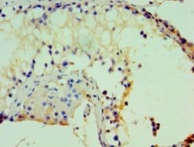 PRTFDC1 / HHGP Antibody (aa2-225, HRP)