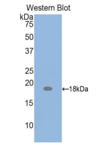 PTHLH / PTHRP Antibody (aa37-175)