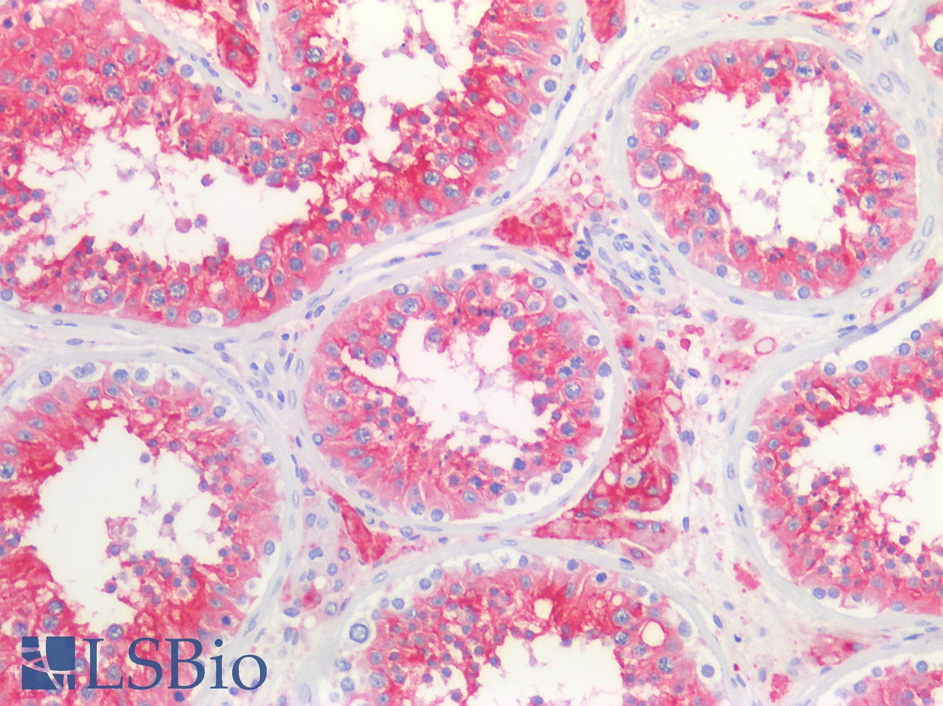 Monoclonal Mouse anti-Human ACE2 / ACE-2 Antibody (clone AC18F, IHC, WB)