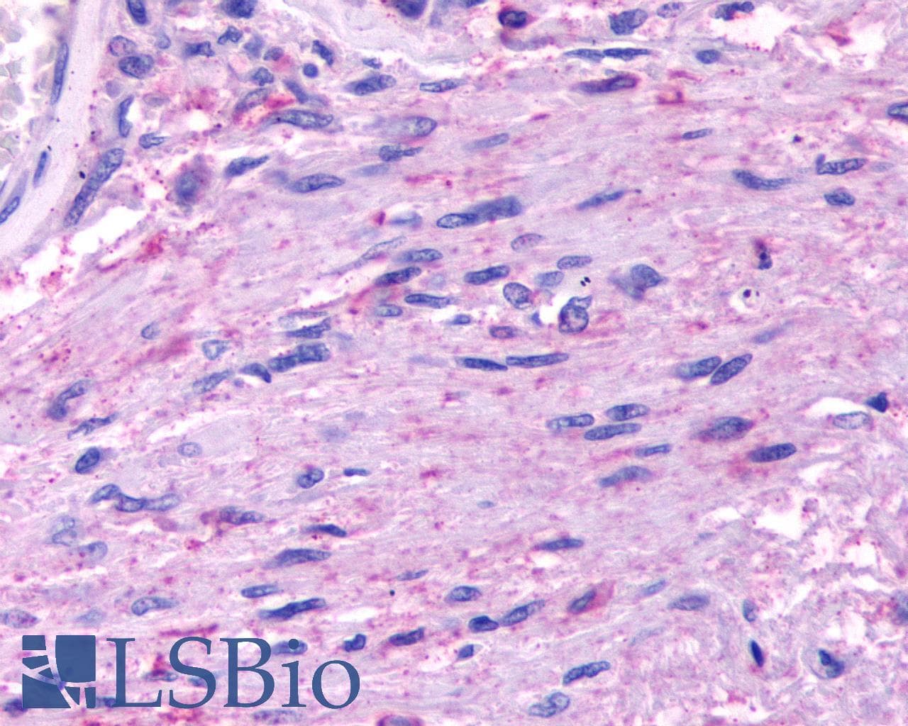 PathPlus™ HTR5A / 5-HT5A Receptor Antibody (Cytoplasmic Domain)