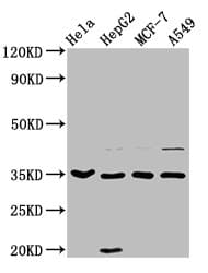 AIMP1 / EMAP II Antibody
