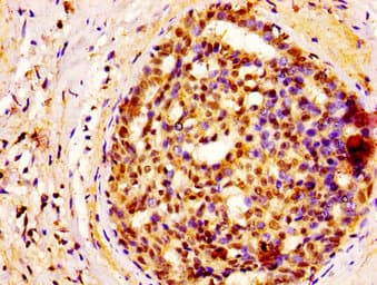 Polyclonal Rabbit anti-Human GSPT1 Antibody (IHC, IF)