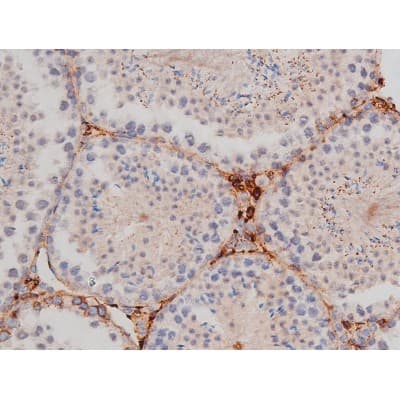 Polyclonal Rabbit anti-Human MAPT / Tau Antibody (phospho-Thr181, IHC, WB)