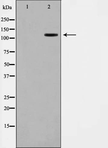 XRN2 Antibody