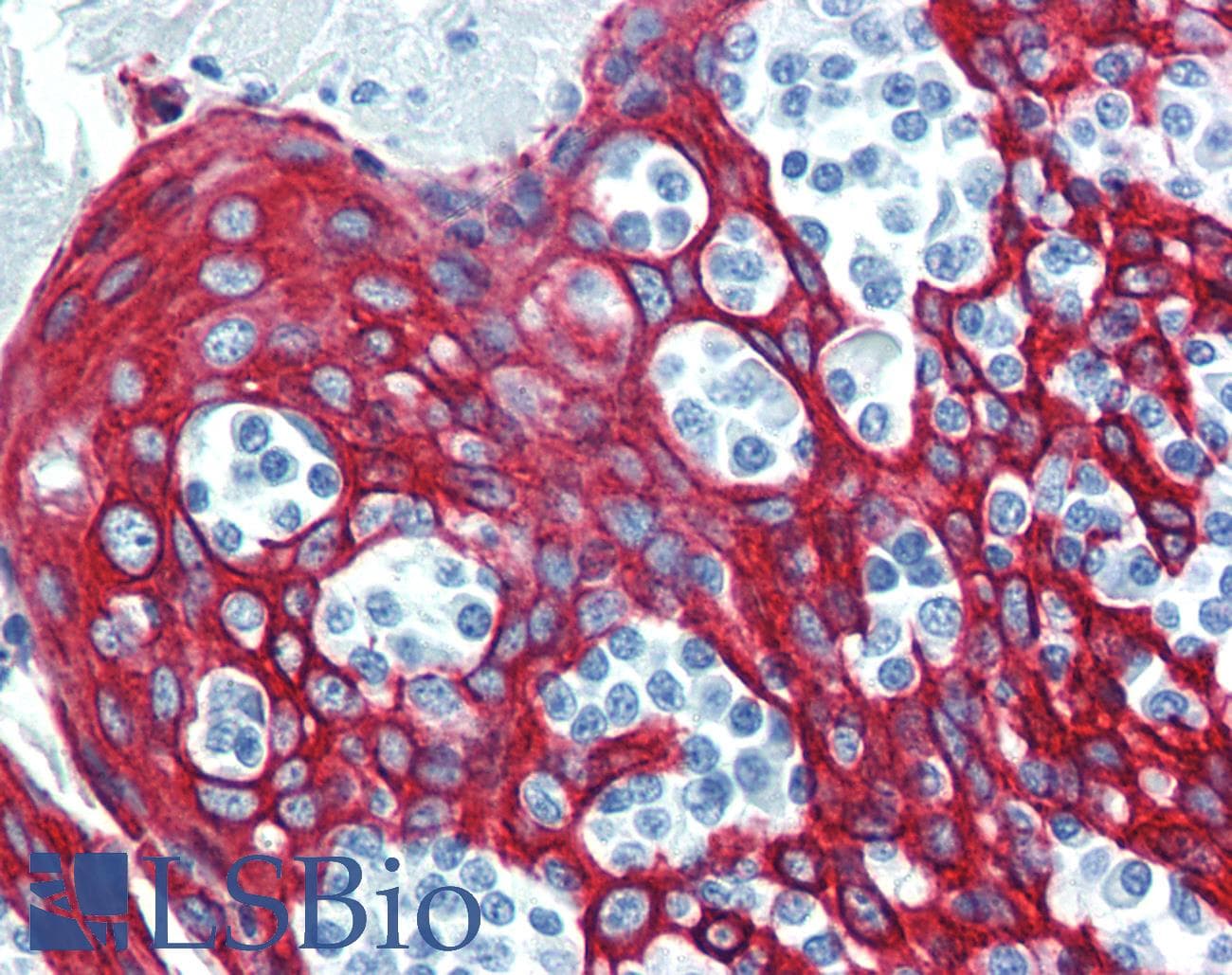 PathPlus™ KRT14 / CK14 / Cytokeratin 14 Antibody (C-Terminus, clone D19-N)