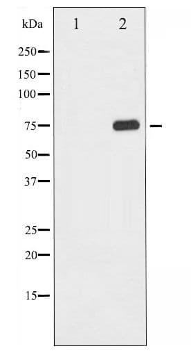 RELA / NFKB p65 Antibody (phospho-Thr435)