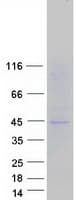 Human SLC16A13 Protein (Recombinant Myc-DDK (Flag))