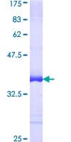 Human CUL7 Protein (Recombinant GST, N-terminus)
