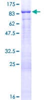 Human URP2 / FERMT3 Protein (Recombinant GST)