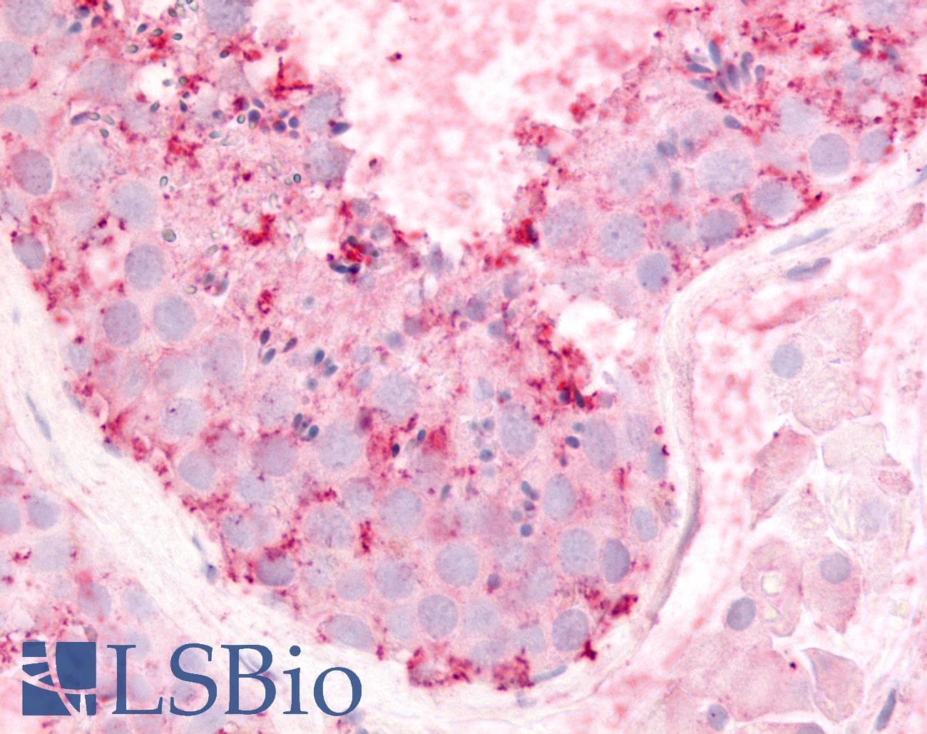 IHC-plus™ GPR182 / ADMR Antibody (C-Terminus)