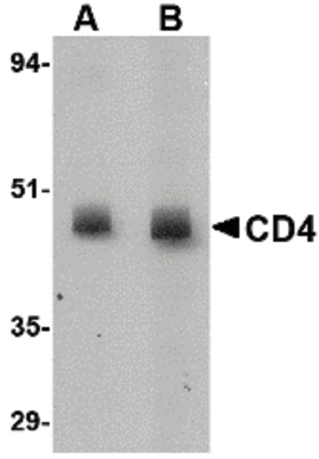 CD4 Antibody (clone 8G1B12)