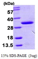 Human HDHD3 Protein (Recombinant His)