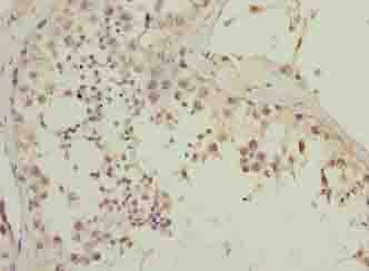 Polyclonal Rabbit anti-Human CGGBP1 Antibody (IHC)