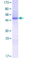 Human YRDC Protein (Recombinant GST)