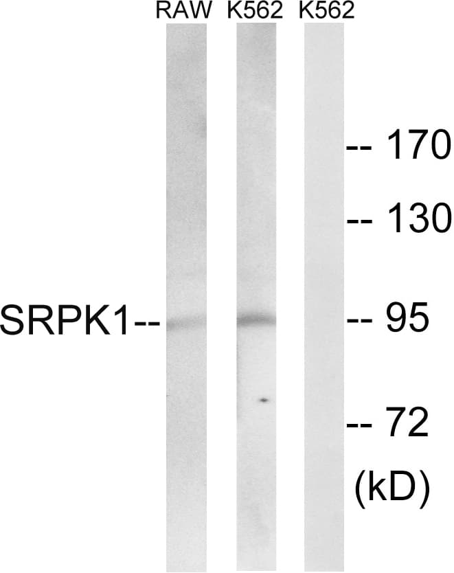 Polyclonal Rabbit anti-Human SRPK1 Antibody (aa521-570, WB)