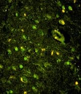 Polyclonal Rabbit anti-Human KHSRP / FBP2 Antibody (aa94-122, IHC, IF, WB)