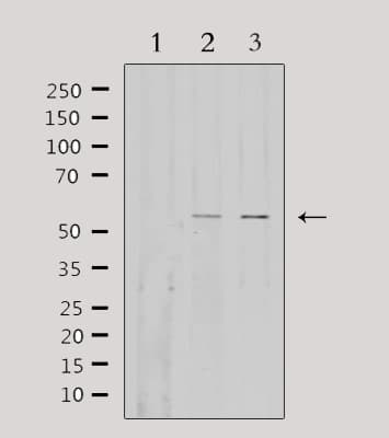 Fibulin-3 / EFEMP1 Antibody