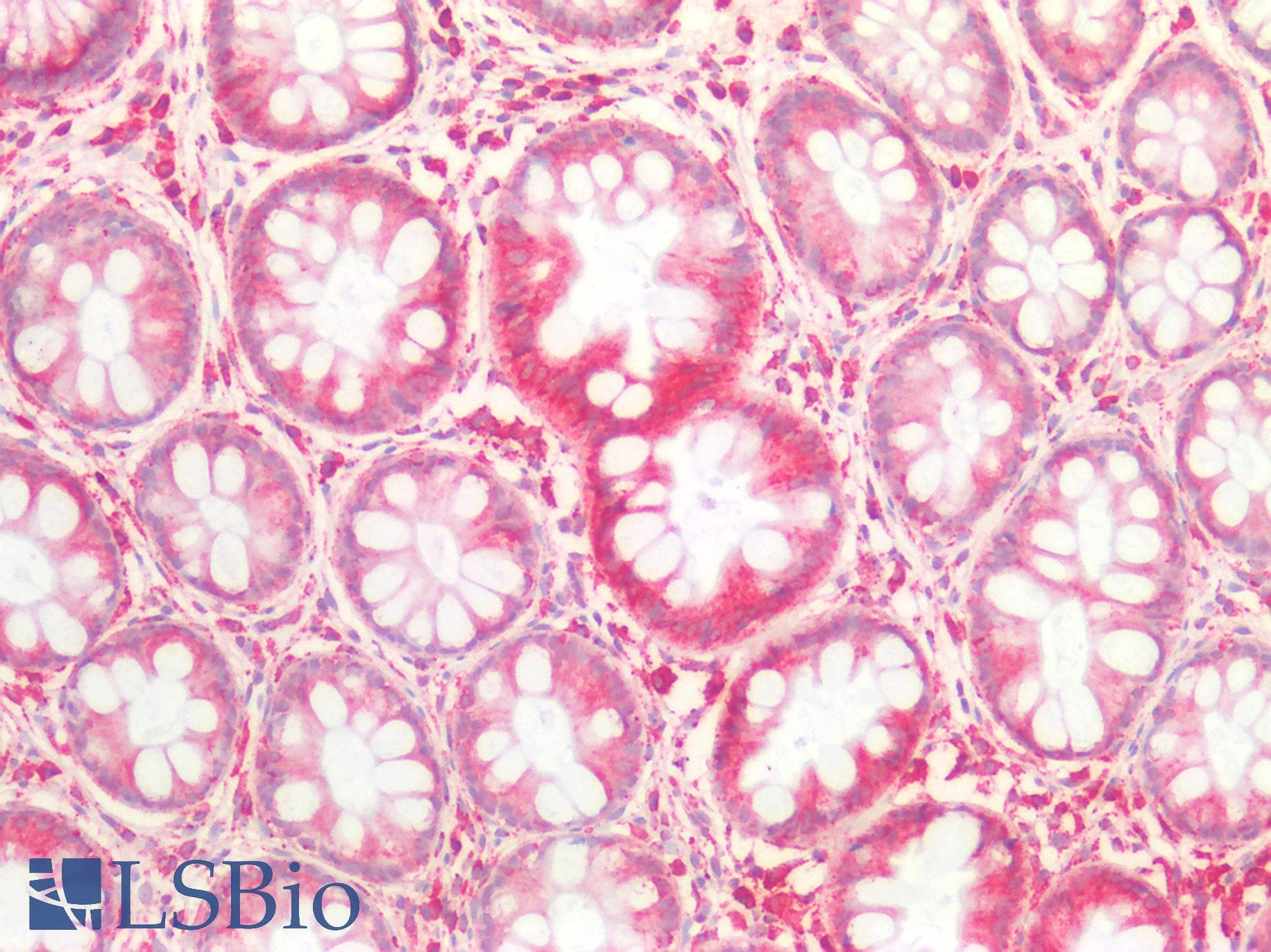 PathPlus™ CD47 Antibody