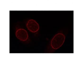 NUP153 Antibody (aa1456-1475)
