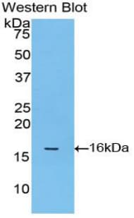 S100A8 / MRP8 Antibody (aa1-89)