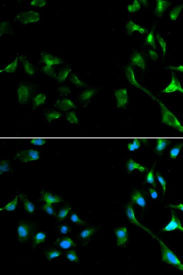 MAPK1 / ERK2 Antibody