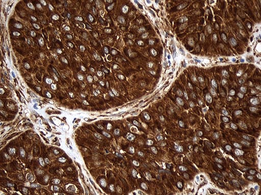 RPL27 / Ribosomal Protein L27 Antibody (clone OTI6D3)