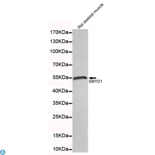 SMYD1 Antibody
