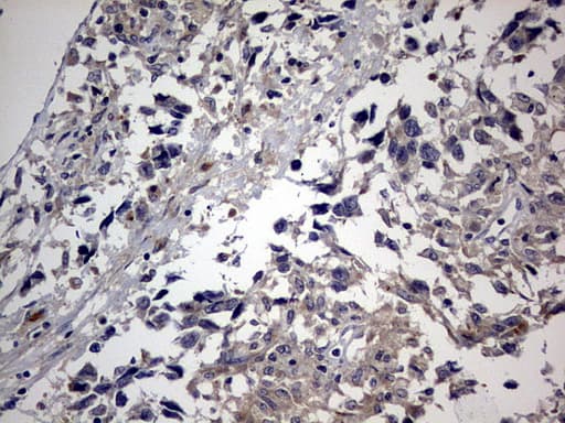 Monoclonal Mouse anti-Human RIPK3 / RIP3 Antibody (clone OTI2F12, aa233-518, IHC, WB)