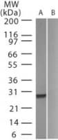 Polyclonal Rabbit anti-Aequorea victoria GFP Antibody (aa102-118, WB)