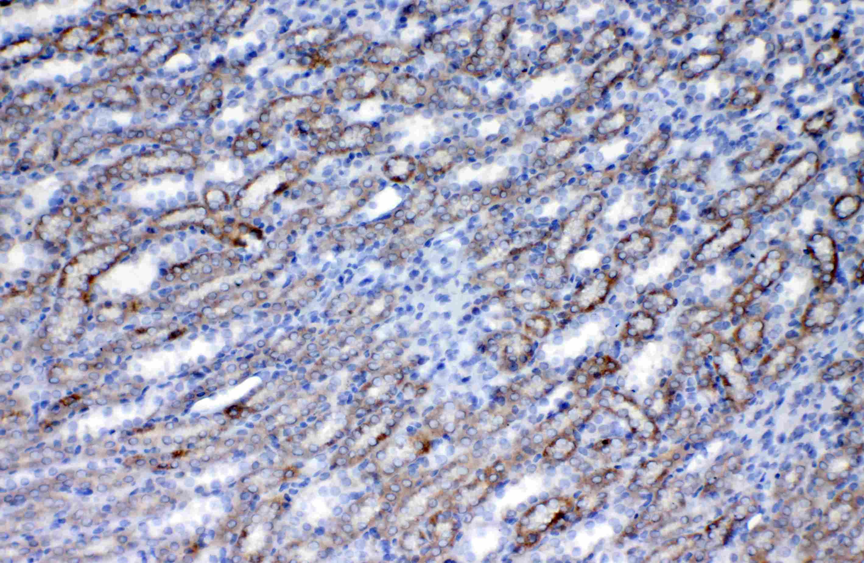 Polyclonal Rabbit anti-Mouse CD135 / FLT3 Antibody (IHC, WB)