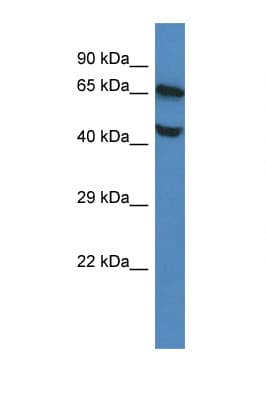 Polyclonal Rabbit anti-Mouse FLVCR / FLVCR1 Antibody (aa223-272, WB)