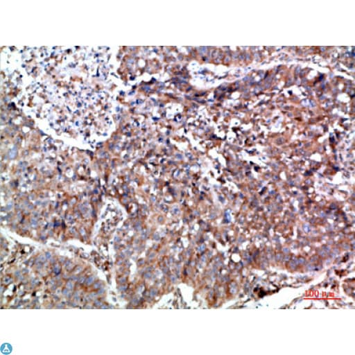 PTEN Antibody