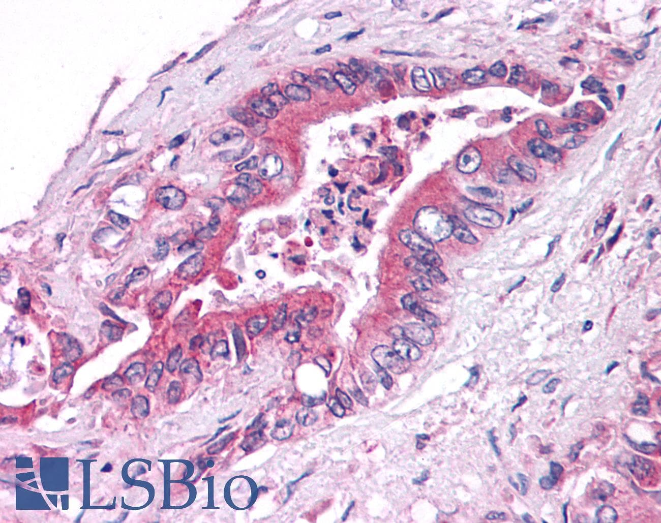 PathPlus™ Polyclonal Rabbit anti-Human GPER1 / GPR30 Antibody (C-Terminus, IHC, IF, WB)