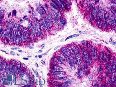 PathPlus™ Polyclonal Rabbit anti-Human GPR21 Antibody (Transmembrane Domain, IHC)