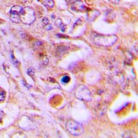 RPL18 / Ribosomal Protein L18 Antibody (Internal)