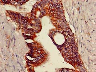Polyclonal Rabbit anti-Human VR1 / TRPV1 Antibody (IHC, IF)
