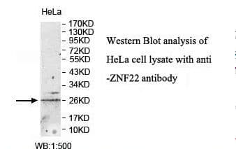 ZNF22 Antibody (aa1-224)