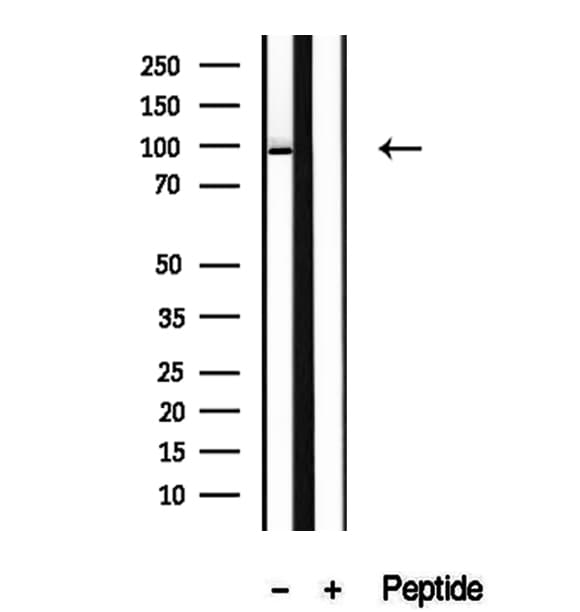 AGO2 / EIF2C2 Antibody
