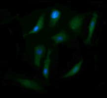 CD105 Antibody (clone OTI3H5, Carrier-free)