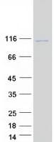 Human STIM2 Protein (Recombinant Myc-DDK (Flag))