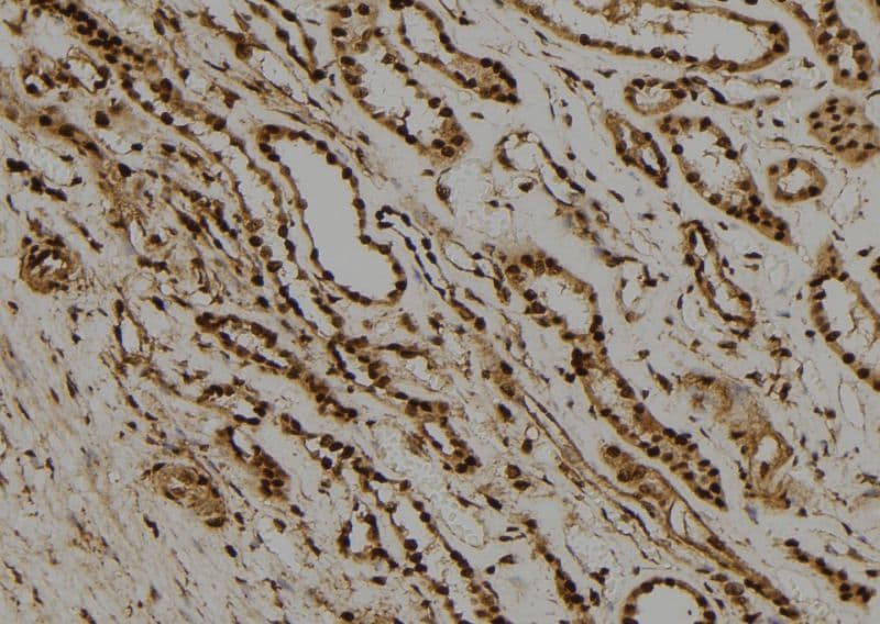 RAD21 Antibody