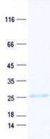 Human PMCH / MCH Protein (Recombinant His, N-Terminal)
