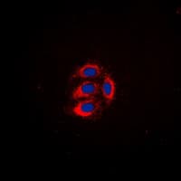 Polyclonal Rabbit anti-Human LYN Antibody (C-Terminus, IHC, IF, WB)