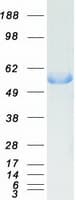 Human DDC / DOPA Decarboxylase Protein (Recombinant Myc-DDK (Flag))