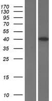 Human CCNJ Protein (Over-Expression Lysate Myc-DDK (Flag))