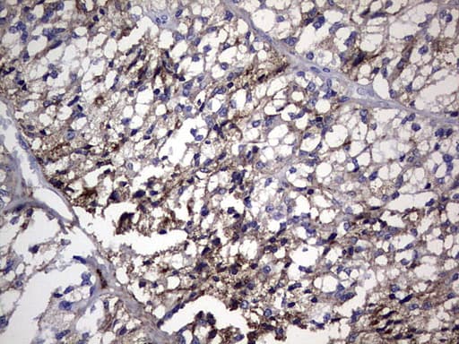 TG / Thyroglobulin Antibody (aa20-358, clone OTI1B2)