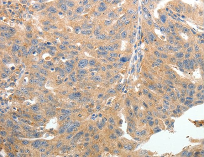 TERT / Telomerase Antibody