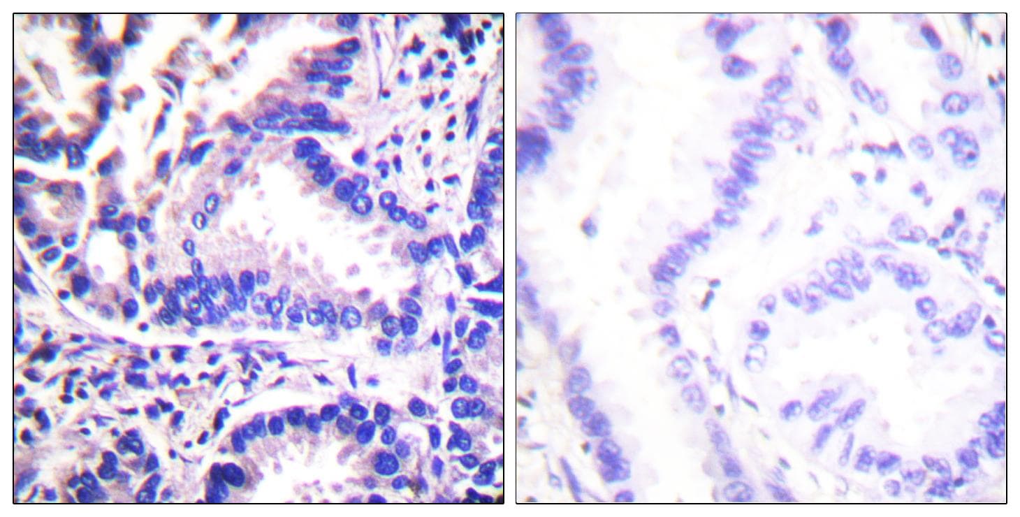 SNCG / Gamma-Synuclein Antibody